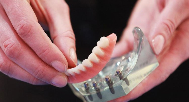 A denture that fits properly can change your life. 